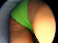 Bright green panty upskirt view under jeans pinafore dress was totally unexpected for me. But's that's a cool upskirt view for a change!
